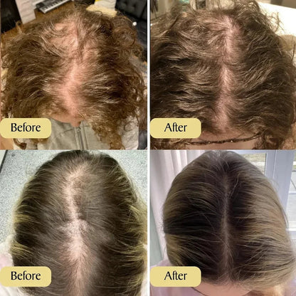 Advanced Hair Density Roll-On Serum - Hair Density Miracle, Anti Hair Fall Scalp Care for Men & Women